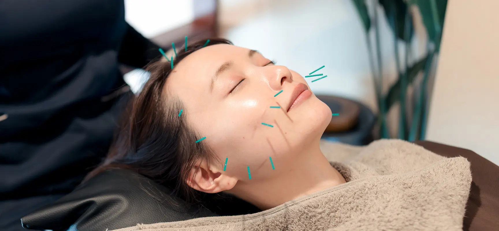 鍼灸について イメージ